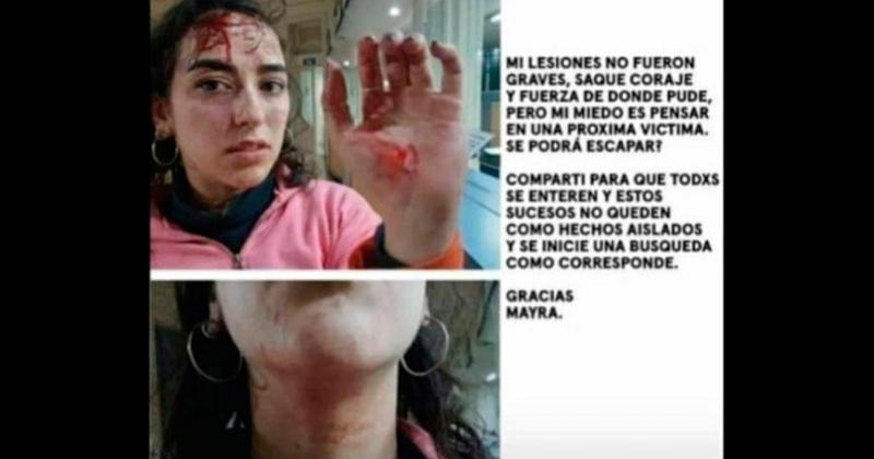 Una joven denuncioacute un ataque en Parque Sur