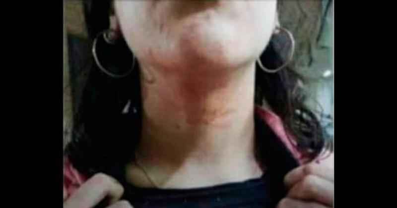 Una joven denuncioacute un ataque en Parque Sur