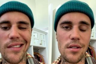 Justin Bieber canceloacute varios shows de su gira por sufrir una paraacutelisis facial